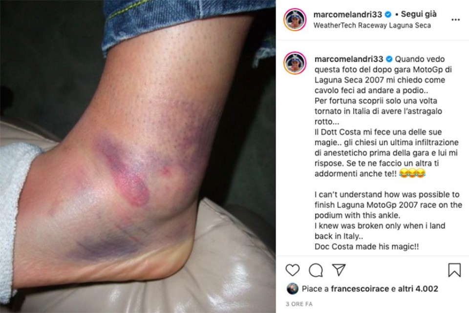 MotoGP: Marco Melandri e quel miracolo del Dottor Costa a Laguna Seca nel 2007