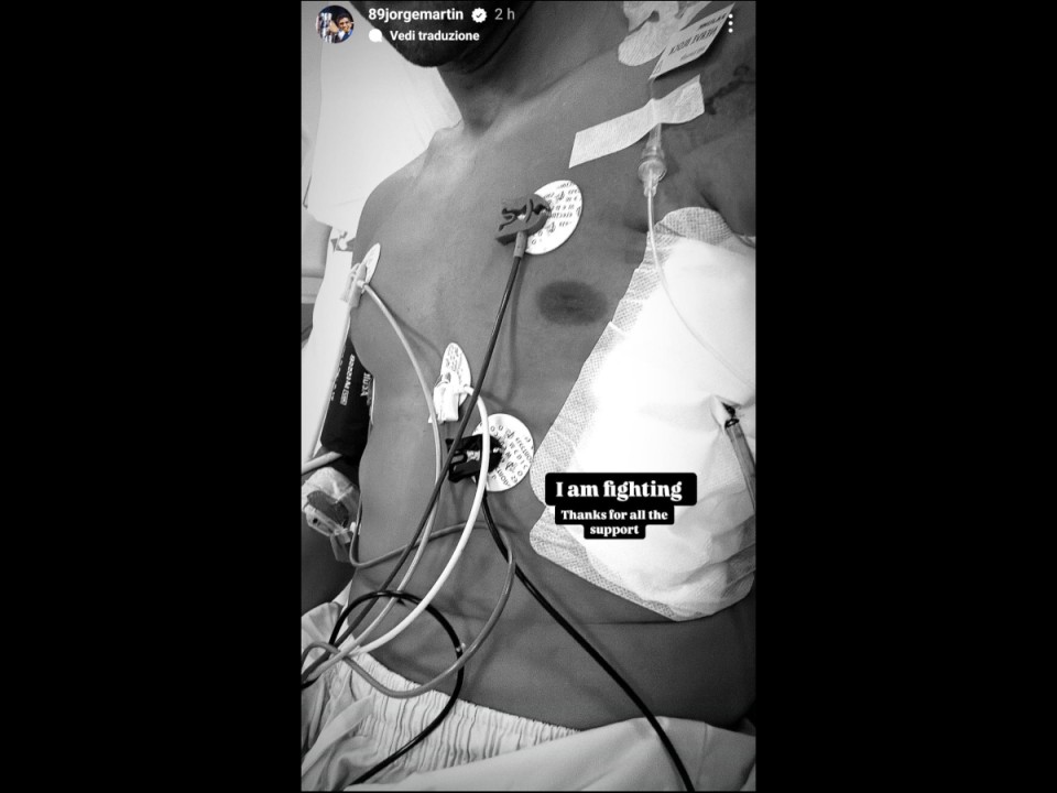 MotoGP: Jorge Martin ancora in ginocchio: l'unica cura è il tempo