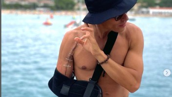 MotoGP: Marc Marquez relaxes by the sea and shows his scar