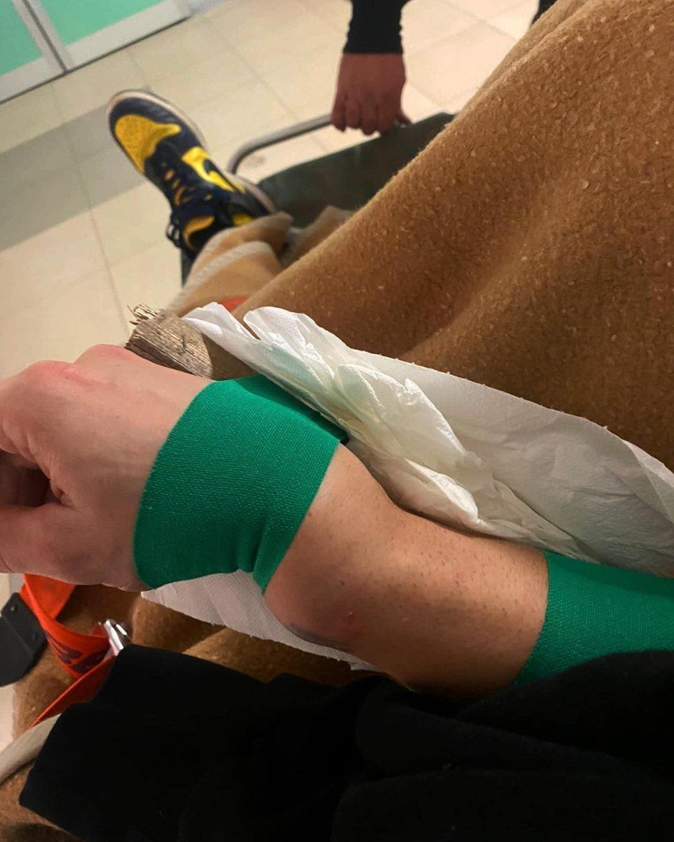 MotoGP: Dovizioso fa il botto nel motocross: frattura scomposta del polso destro