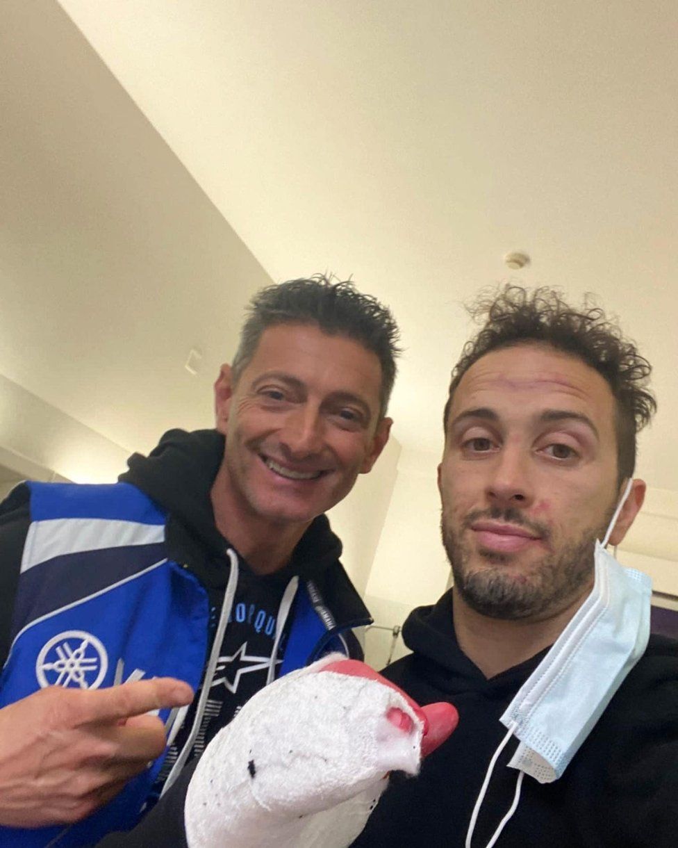 MotoGP: Dovizioso fa il botto nel motocross: frattura scomposta del polso destro