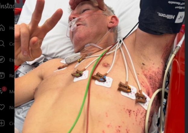 MotoGP: Brutta botta per Troy Bayliss. Il campione australiano si è steso in allenamento