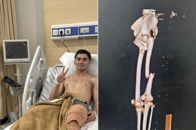 Moto3: Frattura scomposta al femore per David Munoz: è stato operato in Indonesia