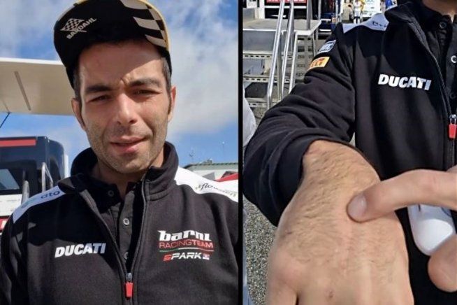 SBK: Petrucci stringe i denti per Estoril: “Vedremo come andrà il dolore dopo le FP1”