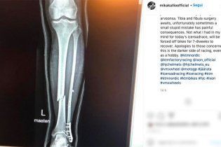 MotoGP: Kallio mette nei guai KTM: frattura a tibia e perone, out per due mesi