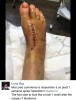 Loris Baz: now my foot seems my foot